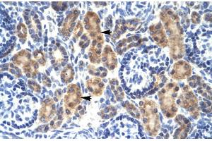 Rabbit Anti-MYCBP Antibody Catalog Number: ARP31860 Paraffin Embedded Tissue: Human Kidney Cellular Data: Epithelial cells of renal tubule Antibody Concentration: 4.
