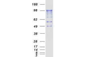 Validation with Western Blot