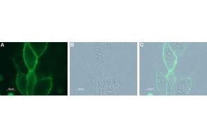 Expression of KCNN4 in live intact human LNCaP prostate carcinoma cells - Cell surface detection (green) of KCNN4 in live intact human LNCaP prostate carcinoma cells with Mouse Anti-KCNN4 (KCa3.