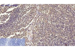 Immunohistochemistry of paraffin-embedded Human tonsil tissue using CD68 Monoclonal Antibody at dilution of 1:200. (CD68 anticorps)