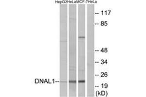 Western blot analysis of extracts from HeLa/HepG2/MCF-7 cells, using DNAL1 Antibody. (DNAL1 anticorps  (AA 121-170))