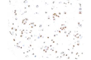 Immunocytochemistry (ICC) image for anti-ThPok (AA 250-300) antibody (ABIN7455169) (Recombinant ThPok (AA 250-300) anticorps)