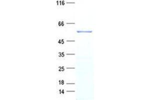 Validation with Western Blot