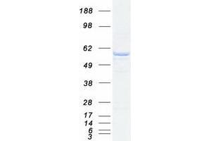 Validation with Western Blot