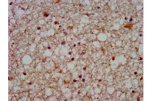 IHC image of ABIN7170083 diluted at 1:500 and staining in paraffin-embedded human brain tissue performed on a Leica BondTM system.