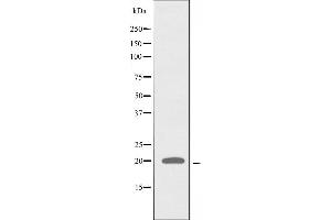 Western blot analysis of extracts from COLO cells, using RPL27A antibody. (RPL27A anticorps  (C-Term))