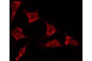 ABIN6278329 staining HepG2 by IF/ICC. (REM1 anticorps  (N-Term))