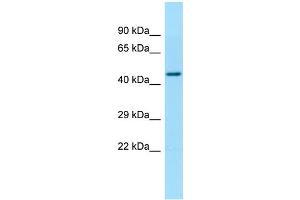 WB Suggested Anti-TBCEL Antibody Titration: 1.