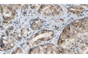 ABIN6277530 at 1/100 staining Human prostate tissue by IHC-P. (Golgin A2 (GOLGA2) (N-Term) anticorps)