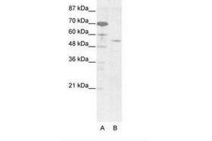 Image no. 1 for anti-Homeobox even-skipped homolog protein 2 (EVX2) (AA 63-112) antibody (ABIN203247) (EVX2 anticorps  (AA 63-112))