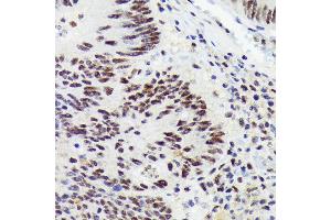 Immunohistochemistry of paraffin-embedded human colon carcinoma using RNF40 Rabbit mAb (ABIN7270074) at dilution of 1:100 (40x lens). (RNF40 anticorps)