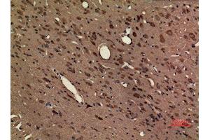 Immunohistochemistry (IHC) analysis of paraffin-embedded Rat Brain, antibody was diluted at 1:100. (CX3CR1 anticorps  (Internal Region))