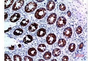 Immunohistochemistry (IHC) analysis of paraffin-embedded Human Colon, antibody was diluted at 1:100. (KRT8 anticorps  (Ser726, Ser731))