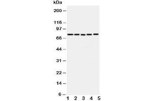Western blot testing of ABCG1 antibody and Lane 1:  U87;  2: SMMC-7721;  3: HeLa;  4: COLO320;  5: MCF-7 cell lysate. (ABCG1 anticorps  (C-Term))