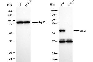 Western blotting analysis using S6K2 antibody (ABIN7800227). (Recombinant RPS6KB2 anticorps)