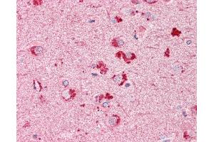 Anti-RIF1 antibody IHC of human brain, cortex. (RIF1 anticorps  (AA 2076-2089))