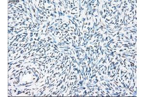 Immunohistochemical staining of paraffin-embedded colon tissue using anti-PPP5Cmouse monoclonal antibody. (PP5 anticorps)