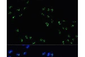 Immunofluorescence analysis of U-2 OS cells using DDX21 Polyclonal Antibody at dilution of 1:100.
