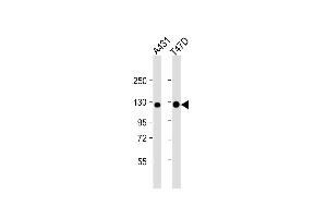 Lane 1: A431 Cell lysates, Lane 2: T47D Cell lysates, probed with CADH1 (1579CT577.