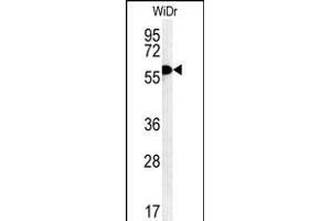 TANK Antibody (Center) (ABIN652041 and ABIN2840515) western blot analysis in WiDr cell line lysates (35 μg/lane). (TANK anticorps  (AA 88-114))