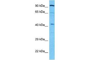 Host:  Rabbit  Target Name:  ALDOB  Sample Type:  721_B Whole Cell lysates  Antibody Dilution:  1.