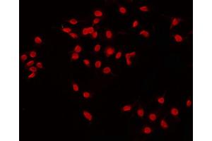 ABIN6268842 staining Hela by IF/ICC.