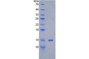 SDS-PAGE analysis of Human Cystatin 1 Protein. (CSTL1 Protéine)