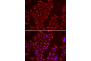 Immunofluorescence analysis of U2OS cell using TPP2 antibody. (Tpp2 anticorps)