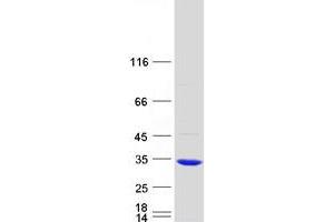 Validation with Western Blot