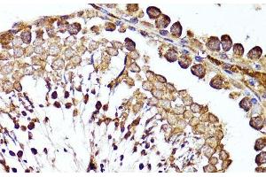 Immunohistochemistry of paraffin-embedded Rat testis using MME Polyclonal Antibody at dilution of 1:100 (40x lens). (MME anticorps)