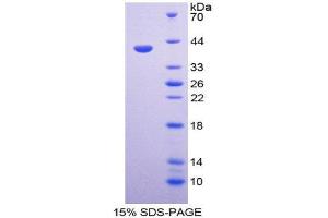SDS-PAGE (SDS) image for Apoptotic Peptidase Activating Factor 1 (APAF1) (AA 31-350) protein (His tag) (ABIN1980886)