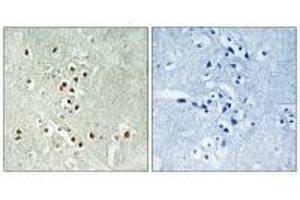 Immunohistochemistry analysis of paraffin-embedded human brain tissue using GADD45GIP1 antibody. (GADD45GIP1 anticorps)