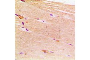 Immunohistochemical analysis of ACTN2 staining in human muscle formalin fixed paraffin embedded tissue section. (ACTN2 anticorps  (N-Term))