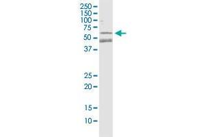 PARK2 monoclonal antibody (M01), clone 1H4.