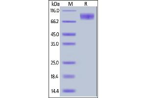 Canine M-CSF R, His Tag on  under reducing (R) condition.
