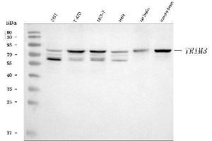 Western blot analysis of TRIM3 using anti-TRIM3 antibody (ABIN7602441).