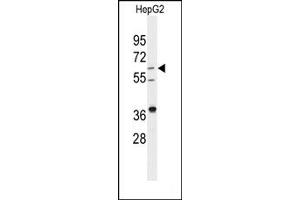 Image no. 1 for anti-24-Dehydrocholesterol Reductase (DHCR24) (Middle Region) antibody (ABIN358015) (Seladin 1 anticorps  (Middle Region))