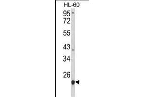 Western blot analysis of PSMB9 Antibody (C-term) (ABIN652496 and ABIN2842334) in HL-60 cell line lysates (35 μg/lane). (PSMB9 anticorps  (C-Term))