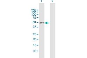 Western Blot analysis of ZCCHC11 expression in transfected 293T cell line by ZCCHC11 MaxPab polyclonal antibody. (ZCCHC11 anticorps  (AA 1-309))