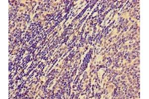 Immunohistochemistry of paraffin-embedded human lymph node tissue using ABIN7161071 at dilution of 1:100 (NCR1 anticorps  (AA 121-230))