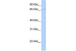 WB Suggested Anti-ZFP64 Antibody Titration:  0. (ZFP64 anticorps  (N-Term))
