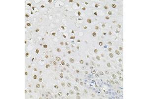 Immunohistochemistry of paraffin-embedded human esophagus using SET/T antibody (ABIN6131351, ABIN6147629, ABIN6147632 and ABIN6216153) at dilution of 1:100 (40x lens).