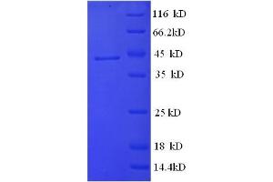 SDS-PAGE (SDS) image for serpin Peptidase Inhibitor, Clade A (Alpha-1 Antiproteinase, Antitrypsin), Member 6 (SERPINA6) (AA 23-405) protein (GST tag) (ABIN5710336)