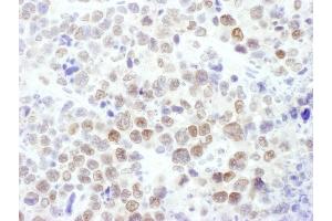 Immunohistochemistry (IHC) image for anti-Enhancer of Zeste Homolog 2 (EZH2) (AA 696-746) antibody (ABIN7450991)