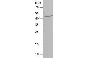 Western Blotting (WB) image for Fucosyltransferase 9 (Alpha (1,3) Fucosyltransferase) (FUT9) (AA 159-359) protein (His-IF2DI Tag) (ABIN7123016)