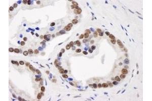 Immunohistochemistry (IHC) image for anti-General Transcription Factor III (GTF2I) (C-Term) antibody (ABIN7448970)