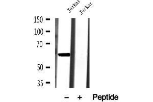 Western blot analysis of extracts of Jurkat cells, using AHCYL1 antibody.