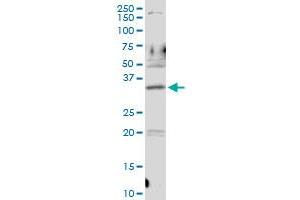 PDLIM1 MaxPab rabbit polyclonal antibody. (PDLIM1 anticorps  (AA 1-329))