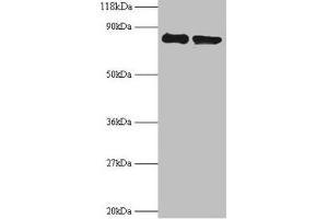 Western blot All lanes: RPS10 antibody at 2 μg/mL Lane 1: EC109 whole cell lysate Lane 2: 293T whole cell lysate Secondary Goat polyclonal to rabbit IgG at 1/15000 dilution Predicted band size: 19 kDa Observed band size: 80 kDa (RPS1 (AA 4-165) anticorps)