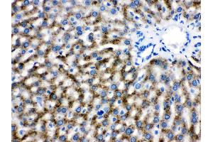 Catalase was detected in paraffin-embedded sections of rat liver tissues using rabbit anti- Catalase Antigen Affinity purified polyclonal antibody (Catalog # ) at 1 µg/mL.